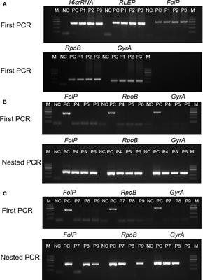 Utility of Multi-target Nested PCR and ELISPOT Assays for the Detection of Paucibacillary Leprosy: A Possible Conclusion of Clinical Laboratory Misdiagnosis